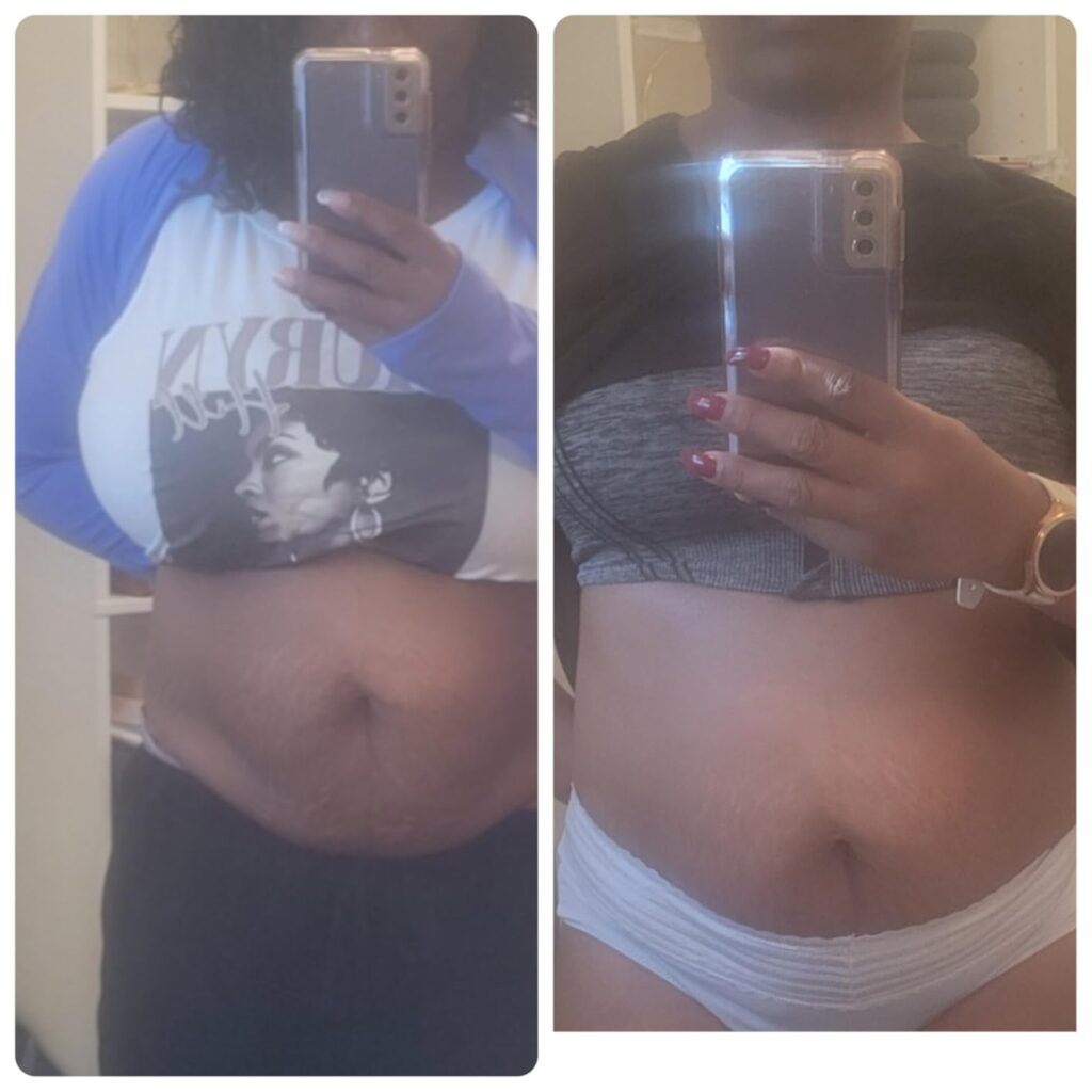 anti cellulite massage oil before and after 