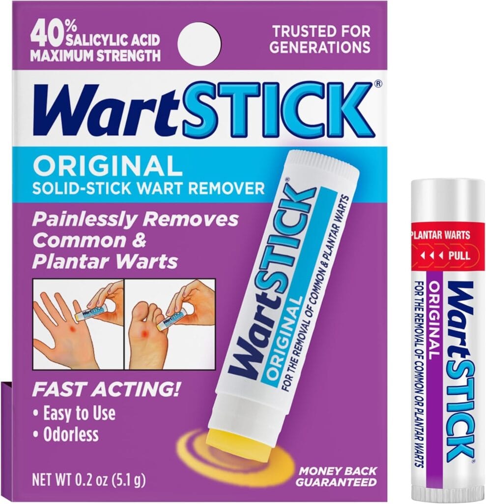 Wart Remover Review