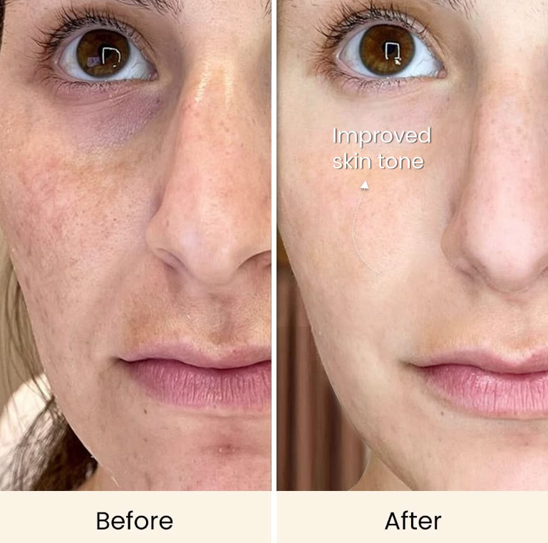 led skin care device