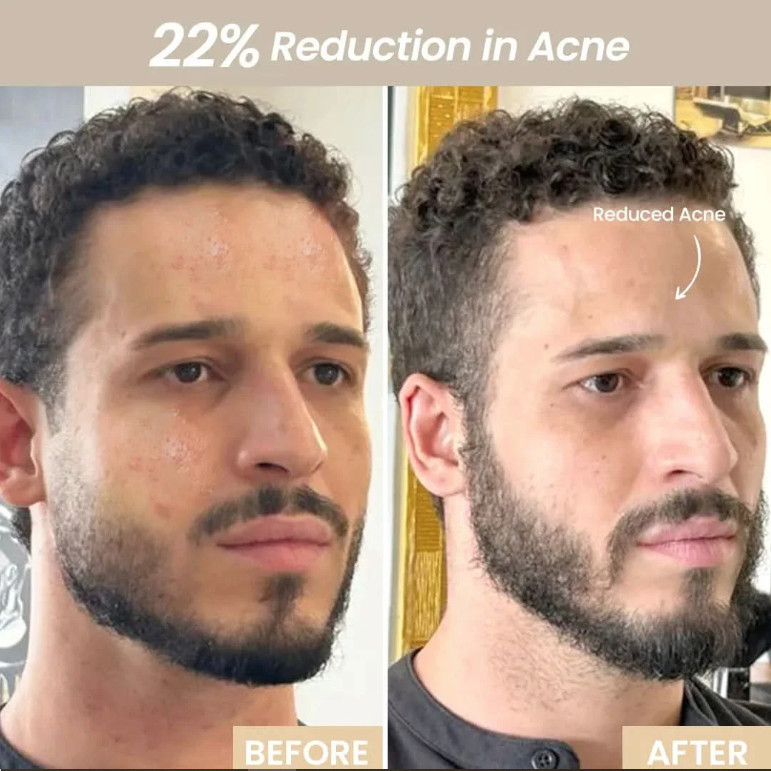 led skin care device